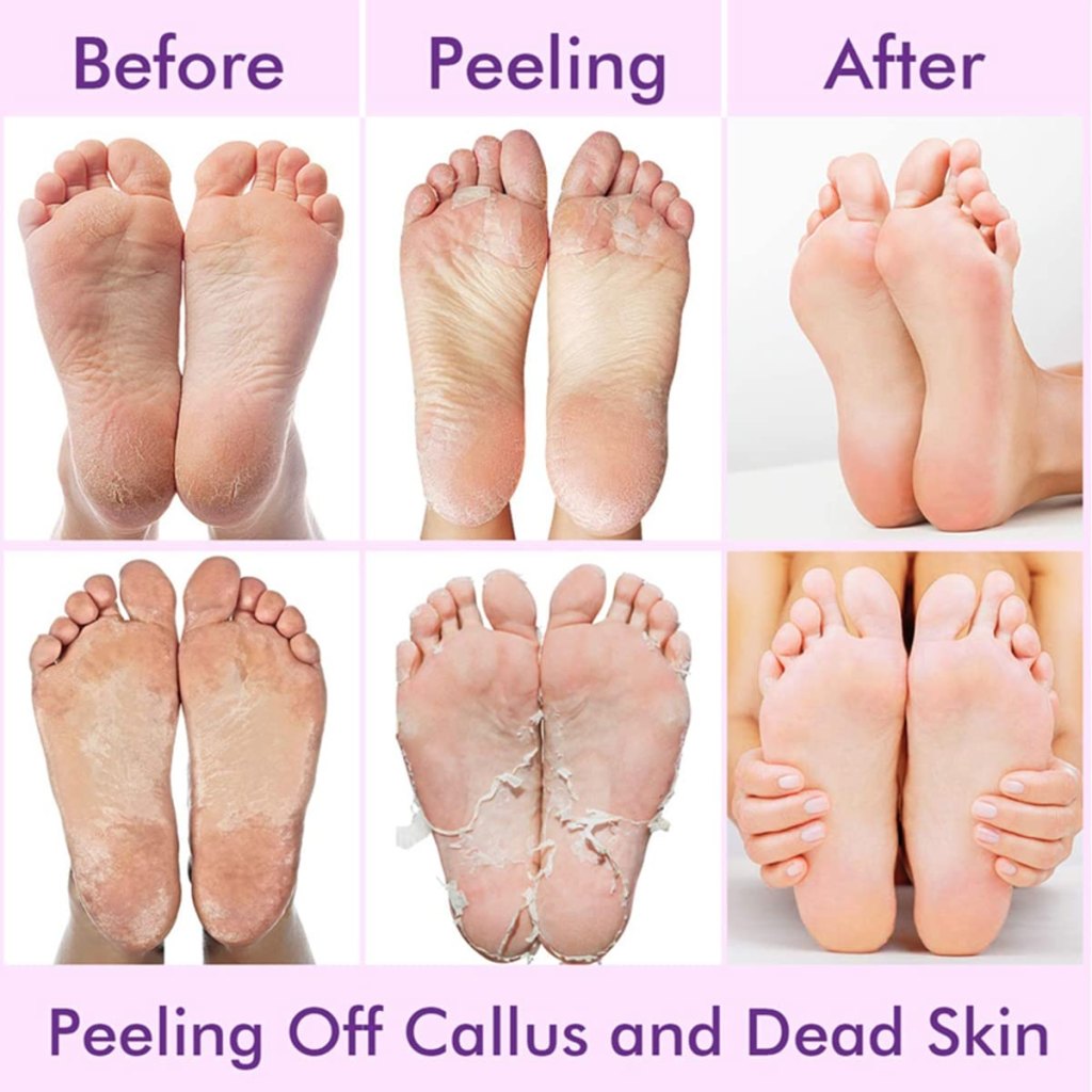 Exfoliating Foot Peeling Mask | Natural Lavender Dead Skin & Callus Remover