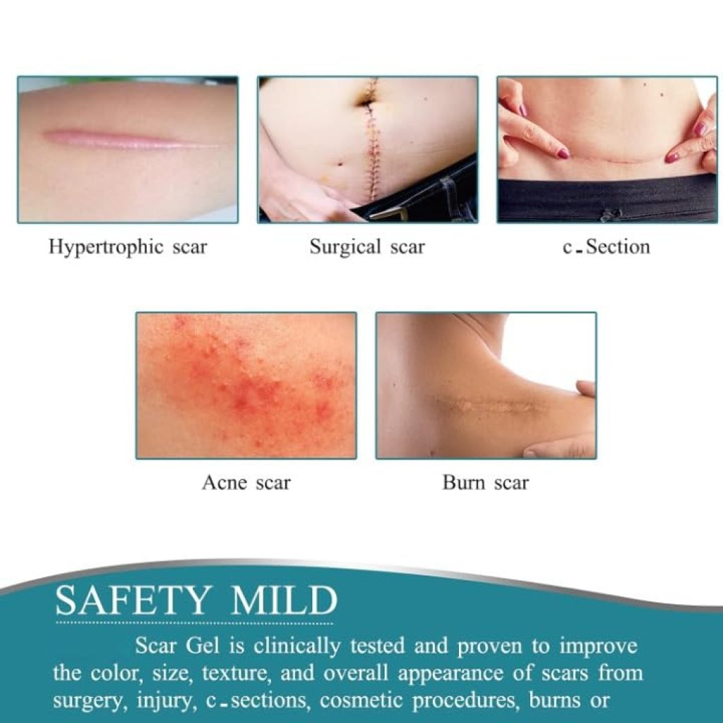 Medical Silicone Scar Removal Tape Roll | Advanced Keloid & C-Section Scar Treatment