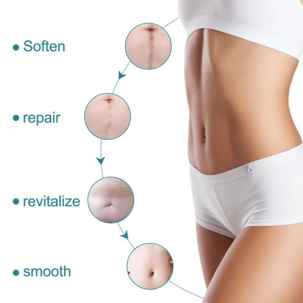Medical Silicone Scar Removal Tape Roll | Advanced Keloid & C-Section Scar Treatment